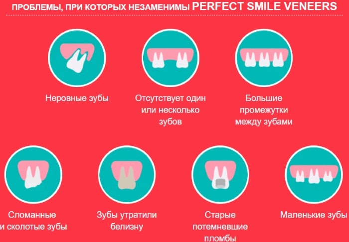 Виниры Perfect Smile Veneers применение