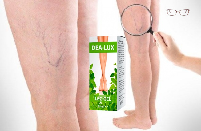 Dea‑Lux гель для ног от варикоза