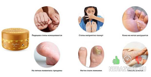 Медовый спас от грибка