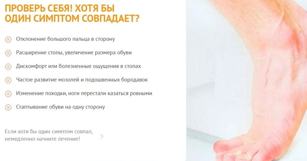 Вальгукорр при вальгусной деформации - принцип действия геля