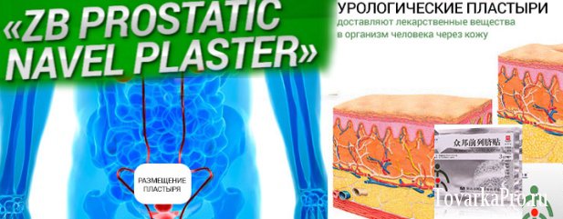 Китайские урологические пластыри zb prostatic navel plaster