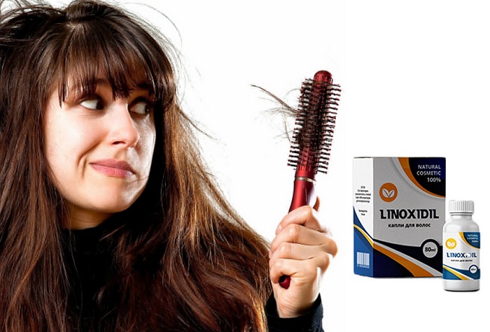 Linoxidil для волос: помогает справиться с алопецией или первыми признаками ее появления!