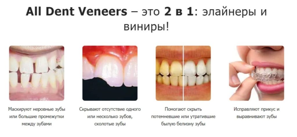 Виниры All Dent Veneers – показания к применению