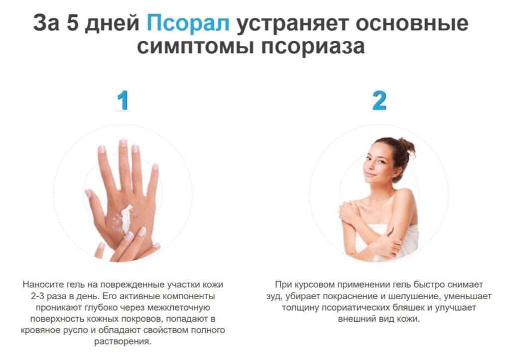 Псорал от псориаза - принцип действия геля