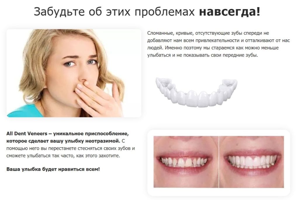 All Dent Veneers - отзывы врачей