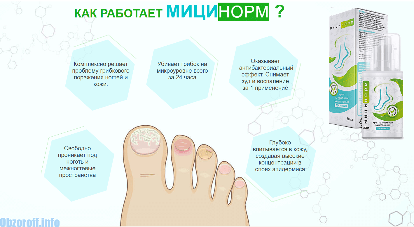 Погода на грибки. Схема лечения грибка ногтей на ногах. Схема комплексного лечения грибка ногтей. Схема лечения грибка ногтей. Схема лечения грибка кожи и ногтей.