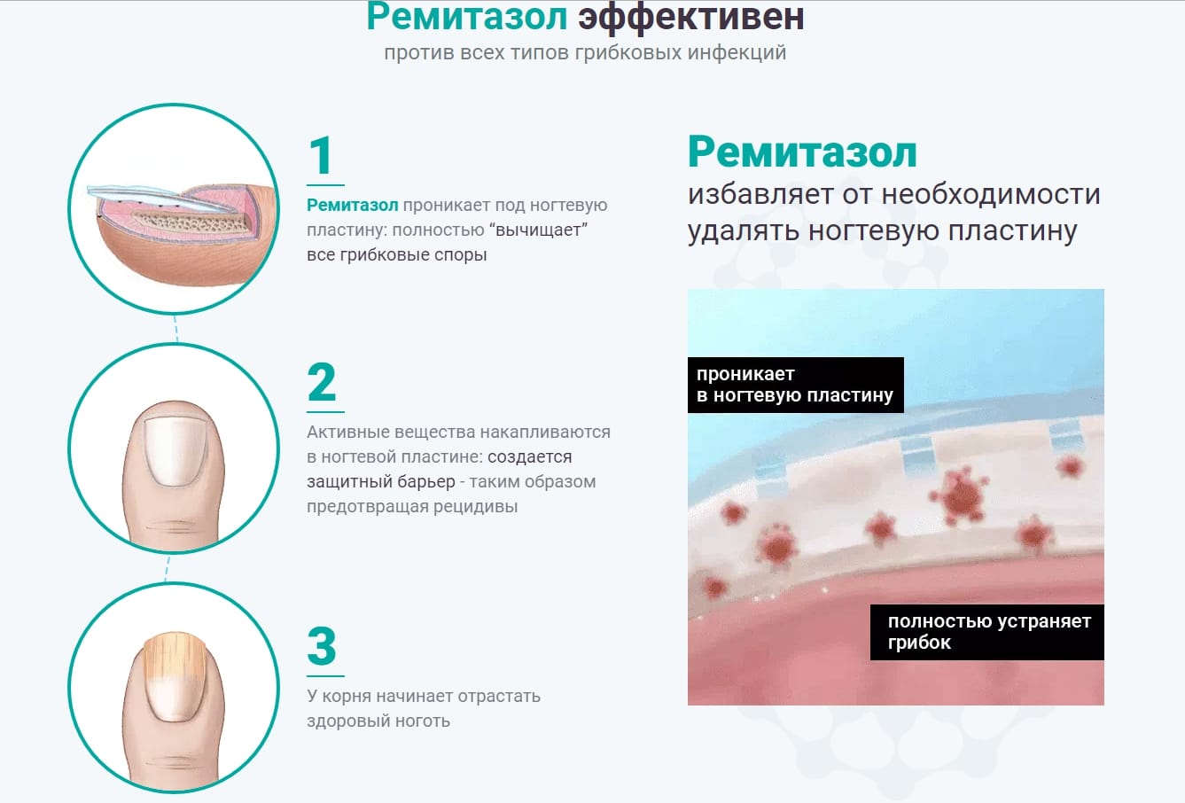 Крем Ремитазол эффективность