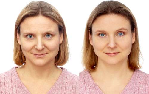Женщина до и после применения сыворотки для лица Serum