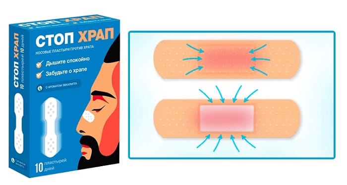 Пластырь для храпа носа. Пластыри от храпа в аптеках. Спрей от храпа. Пластырь от храпа. Лейкопластырь от храпа.