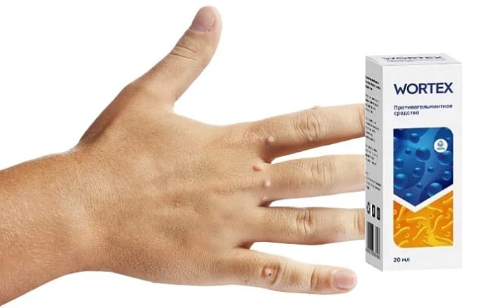 Вортекс от бородавок. Wortex лекарство от папиллом. мазь вортекс от папиллом. вортекс от папиллом отзывы. купить вортекс от бородавок в краснодаре.